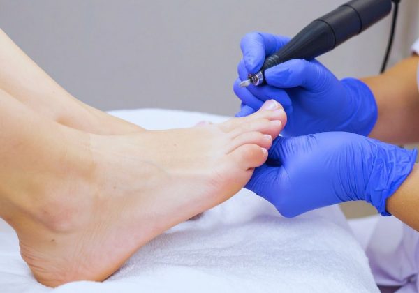 Leczenie stopy cukrzycowej w Warszawie – jak rozpoznać problem i jak o nią dbać